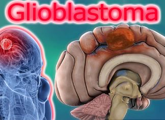 Rab27b – Epiregulin molecules interact to contribute to radioresistance in glioblastoma brain cancer