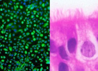COVID-19: Researchers create human airway stem cells from patients’ cells
