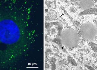 Researchers discovered a new immune defense mechanism orchestrated by lipid droplets (LDs)