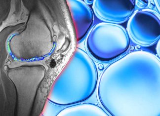 Using a magnetic field and hydrogels: new possible way to rebuild complex body tissues such as cartilage degeneration