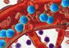 I ricercatori hanno sviluppato un nuovo tipo di vaccino terapeutico preciso contro la leucemia