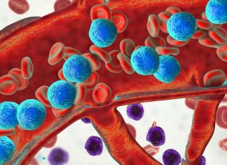 I ricercatori hanno sviluppato un nuovo tipo di vaccino terapeutico preciso contro la leucemia