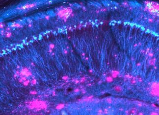 New therapeutic targets for Alzheimer’s disease