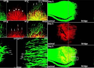 Glial cells that wrap around axons in our corneas have the potential for nerve regeneration and vision preservation
