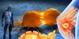 Vitamin D may reduce the risk of developing advanced cancers