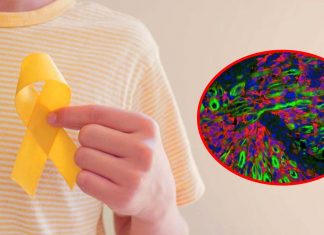 Paroxetine : Antidepressant repurposed to treat childhood sarcoma
