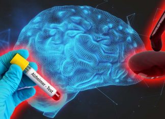 Blood tests can be used to predict Alzheimer’s years before the onset of symptoms