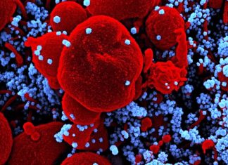 COVID-19: Blood of patients could predict severity of illness