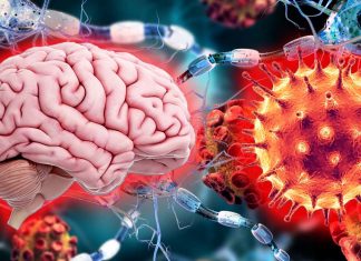 COVID-19: il cervello dei pazienti è suscettibile al danno microvascolare dei vasi sanguigni