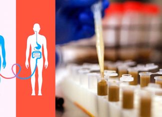 Israele: i trapianti di feci possono aiutare a eliminare i tumori dal corpo