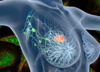 Increased YTHDF3 expression appears to be a key driver in brain metastases