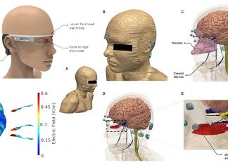 Alzheimer’s disease: the new wearable electrical stimulator can reduce or reverse its onset