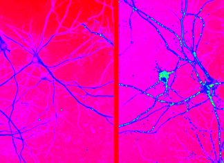 Researchers have identified the type of brain cell that produces collagen 19