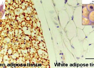 Scientists have discovered a type of cell responsible for triggering inflammation in fat tissue