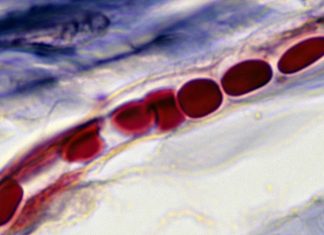 A new endovascular technology can explore capillaries