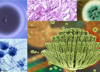 Researchers have identified how a fungal infection triggers inflammation