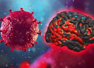 Brain injury caused by HIV can lead to cognitive challenges