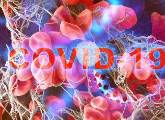 The most severe cases of COVID-19 begin with leaky blood vessels – Why ?