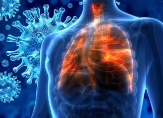 COVID-19 sets up outbreaks in multiple small areas of the lung instead of rapidly infecting large regions