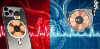 La funzione salvavita di defibrillatore cardiaco di un dispositivo Medtronic impiantato può essere disattivata semplicemente tenendo un iPhone 12 vicino ad esso