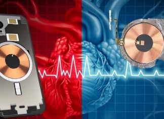 La funzione salvavita di defibrillatore cardiaco di un dispositivo Medtronic impiantato può essere disattivata semplicemente tenendo un iPhone 12 vicino ad esso
