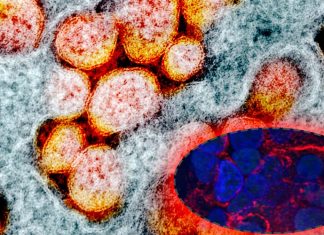 What impact the SARS-CoV-2 virus had inside our lung cells within the first few hours of being infected?