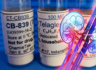 Telaglenastat improve effectiveness of radiation therapy for head – neck cancer