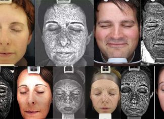 Skin cells: genomic DNA changes from UV light is especially common