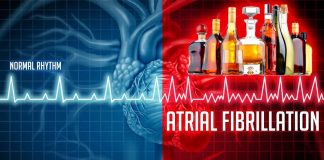 Alcohol has an immediate effect on the heart in patients with atrial fibrillation (AFib)