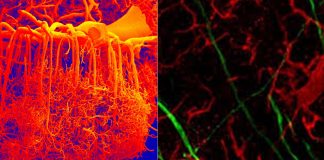 Treat Brain Disorders: A new nanoparticle drug-delivery system resulted in unprecedented siRNA penetration across the intact blood-brain barrier