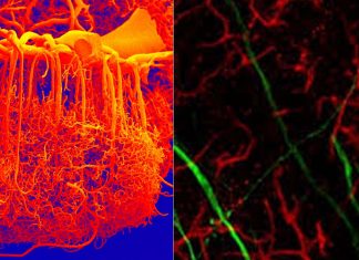 Treat Brain Disorders: A new nanoparticle drug-delivery system resulted in unprecedented siRNA penetration across the intact blood-brain barrier