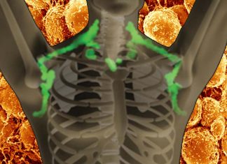 The brown fat may protect against numerous diseases