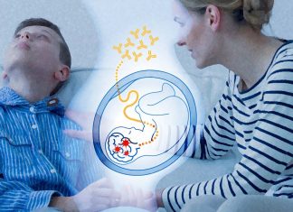 Machine learning has identify with 100% accuracy MAR ASD-specific patterns as potential biomarkers of ASD risk