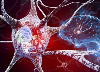 Researchers have created an artificial enzyme to treat Parkinson’s disease