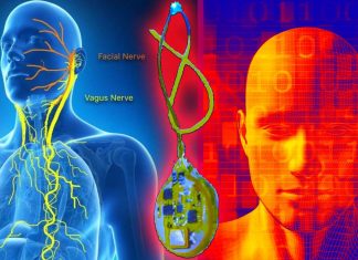 Obesity: a centimeter-sized device provides the feeling of fullness by stimulating the endings of the vagus nerve with light