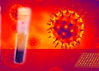 The COVIDAR group developed a quantitative serologic test based on ELISA for SARS-CoV-2 infection