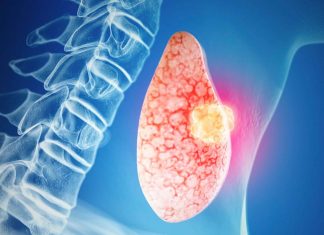 Maternal benign thyroid conditions are strongly associated with thyroid cancer risk in offspring