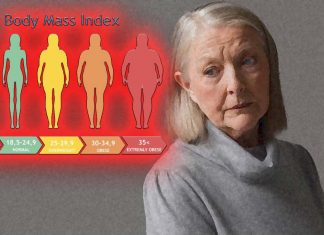 Healthy weight help preserve brain structure in people with mild Alzheimer’s disease dementia