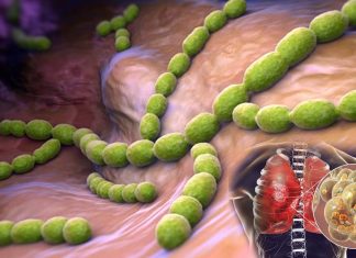 Effectiveness of 13vPCV on children with bacterial pneumonia