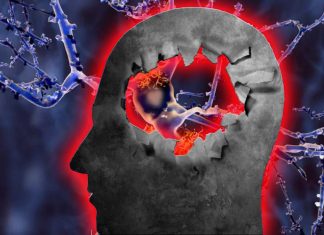 Alzheimer’s disease: Aβ38 beta-amyloid can help people live longer