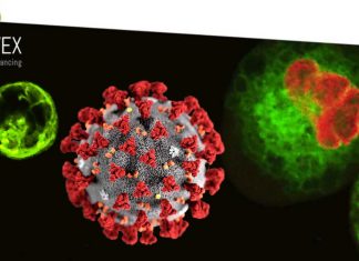 COVID-19: Patients who received Enlivex Therapeutics’ Allocetra therapy survived a 28-day Phase II clinical trial period