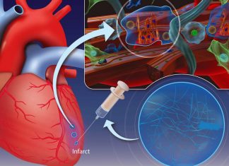 Injectable hydrogel could help repair heart muscle after a heart attack event