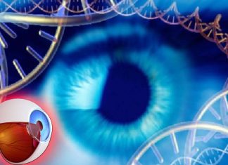 NRTIs – Common HIV drugs may prevent leading cause of vision loss