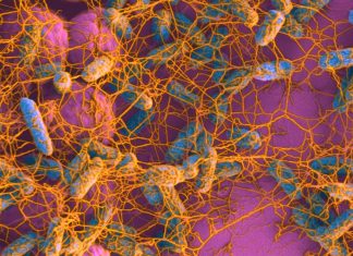 Patients with Crohn’s disease have an overabundance of gut adherent-invasive Escherichia coli (AIEC) bacteria