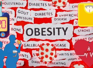COVID-19: two-thirds of hospitalizations are due to four conditions – obesity – hypertension – diabetes – heart failure