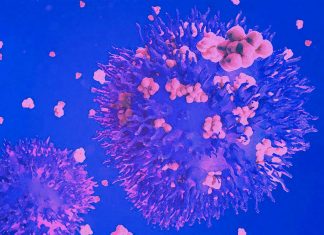 COVID-19: Targeting CCL2 and CCL3 cytokines with inhibitors may calm the immune reaction and prevent lung tissue damage