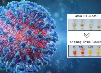 Cap-iLAMP: fast – low-cost method to detect COVID-19