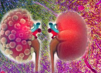 Research found possible link between short telomeres and kidney fibrosis