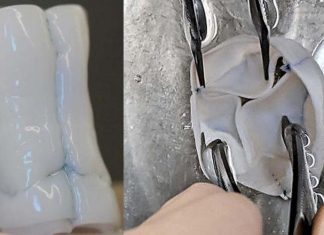 Researchers used a hybrid of tissue engineering and regenerative medicine to create the growing heart valves