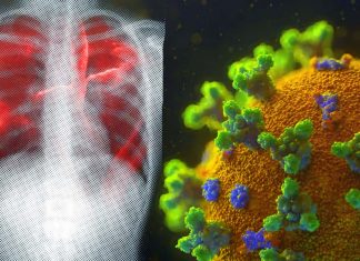 Researchers identify three clinical COVID-19 phenotypes